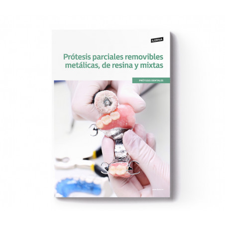 Material Didáctico Módulo 6: Prótesis parciales removibles metálicas, de resina y mixtas