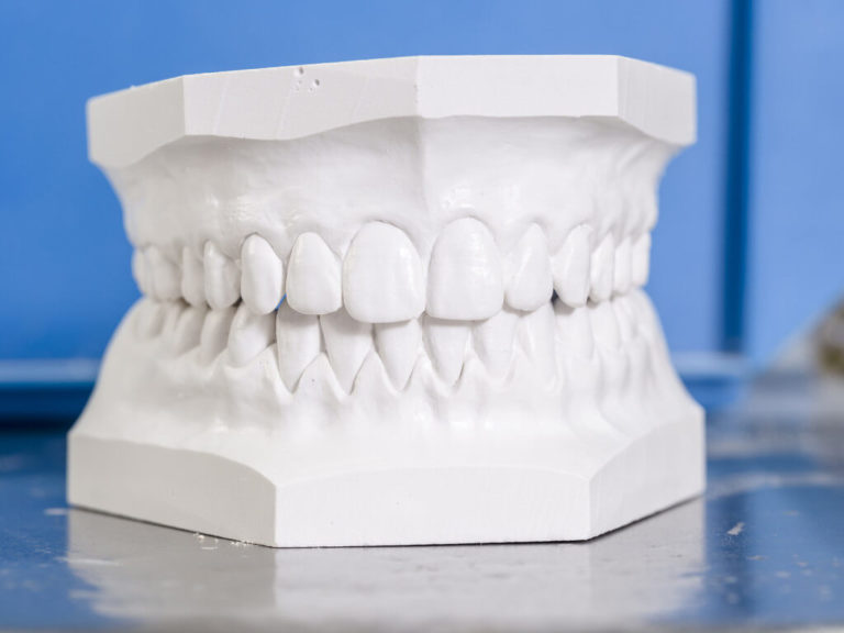 La dentición temporal (20 piezas) y permanente (32 piezas).